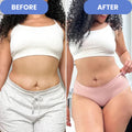 SONIQ - Ultrasonic Body Toner & Cellulite Remover